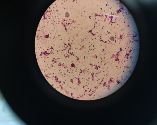 致死性B族链球菌感染，准妈妈不能忽视的产前筛查，你关注过吗？