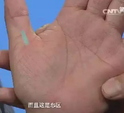 手上出现这些变化可能是疾病信号,手的颜色能看出健康的问题吗