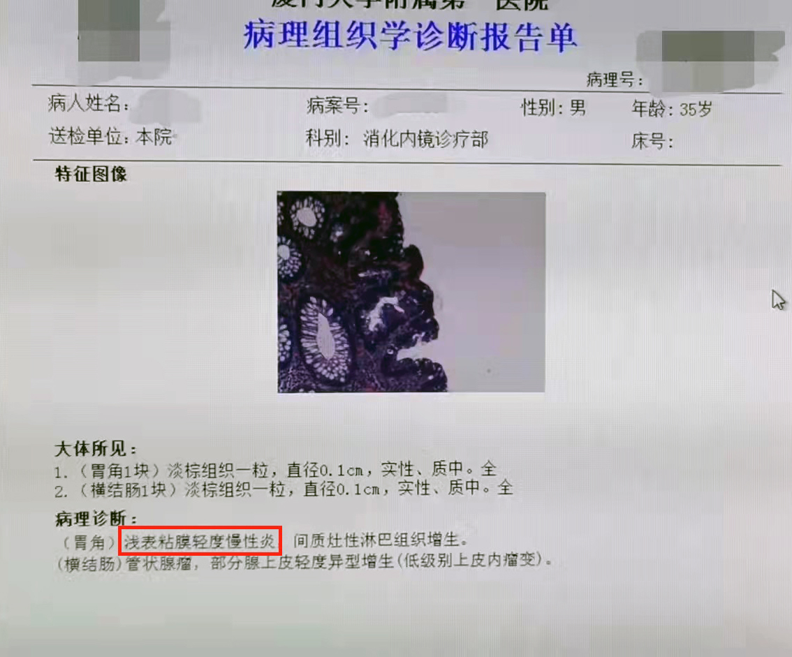 萎缩性胃炎无法逆转？刘慧敏主任：这两点很重要