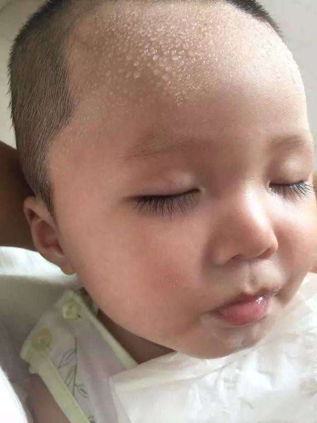 小孩子爱出虚汗需求补锌吗,宝宝出虚汗是缺锌还是缺钙