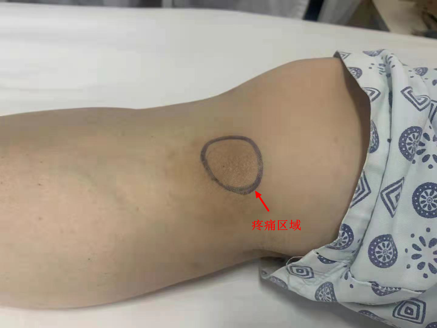 膝盖疼了2年查不出原因,膝盖不明原因疼痛是什么原因