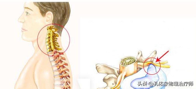 肩膀疼是肩周炎吗还是其他原因,肩周炎肩膀疼痛怎么锻炼