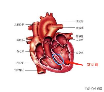 先心宝宝自愈概率,先心病宝宝经历