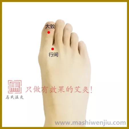 白带多艾灸哪个穴位有效,白带多用艾灸需求灸哪里
