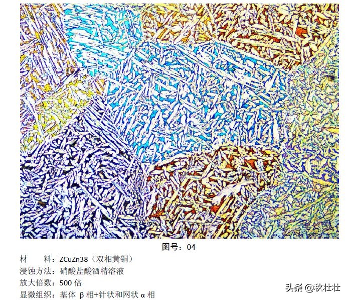马氏体和奥氏体金相图片,马氏体和珠光体金相区分