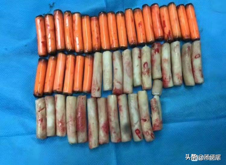 性乃自然之事，毫无可羞丑之处