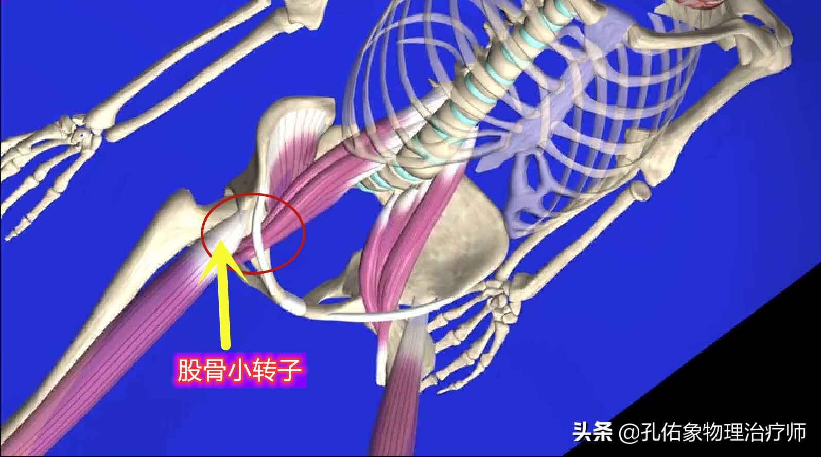 女大腿根内侧疼痛是什么原因,女性左大腿内侧根部疼是怎么回事