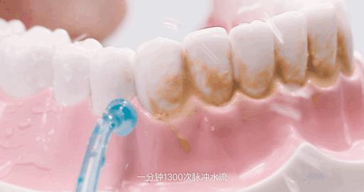 小米冲牙器伤牙,小米有品冲牙器头