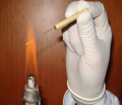 中医火针疗法教学视频,火针动手手法